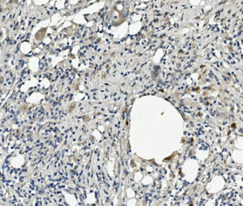 Kallistatin/PI-4/SERPINA4 Antibody