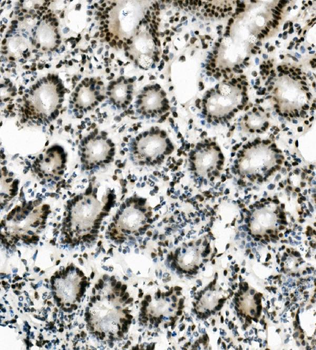 Anti-Vinexin/SORBS3 Antibody