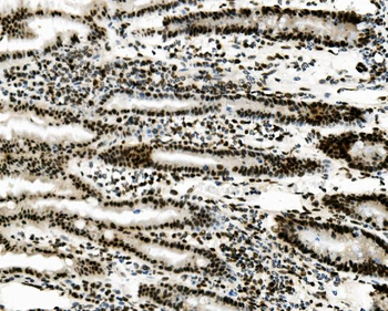 Anti-Vinexin/SORBS3 Antibody