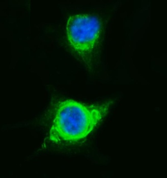 Vinexin/SORBS3 Antibody