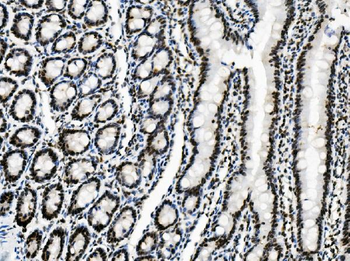 Anti-Vinexin/SORBS3 Antibody