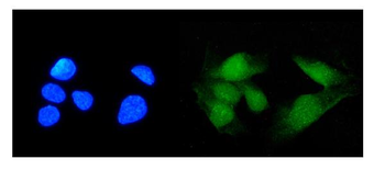 Anti-TRIM21/SS-A Antibody