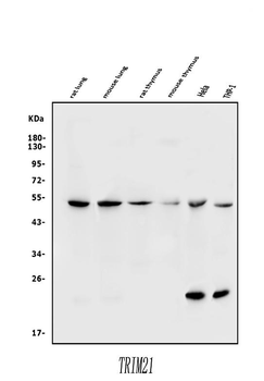 Anti-TRIM21/SS-A Antibody