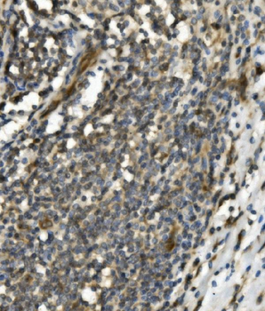 Anti-TRIM25/EFP Antibody