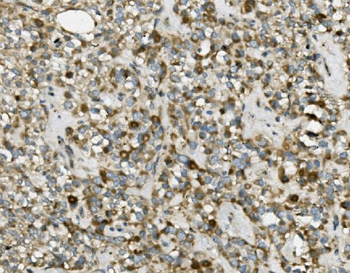 Anti-TRIM25/EFP Antibody