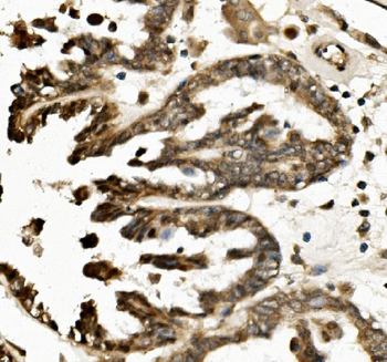 Anti-TXNIP Antibody