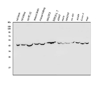 Anti-TXNIP Antibody