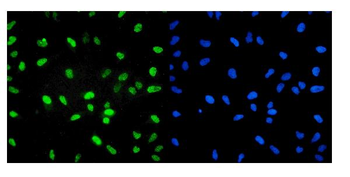 Anti-U2AF65/U2AF2 Antibody