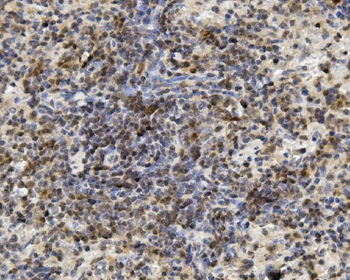 Anti-U2AF65/U2AF2 Antibody