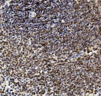 Anti-U2AF65/U2AF2 Antibody