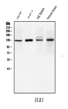 Anti-ULK1 Antibody