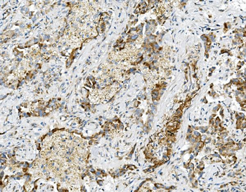 USP16 Antibody