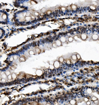 USP16 Antibody