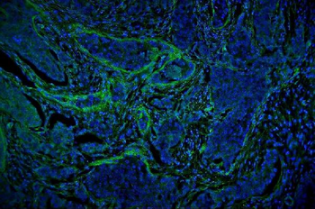 Anti-Vinculin/VCL Antibody