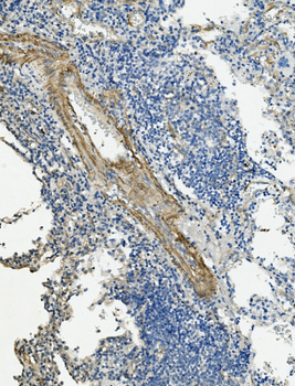 Anti-Vinculin/VCL Antibody