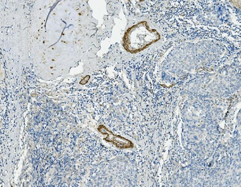 Anti-Vinculin/VCL Antibody