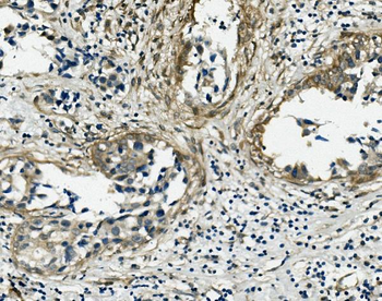 Anti-Vinculin/VCL Antibody