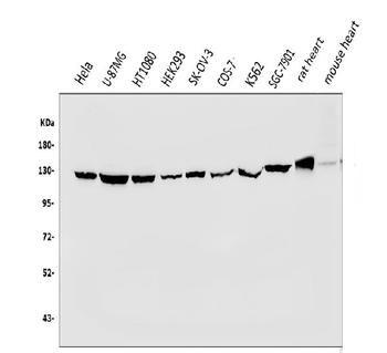 Anti-Vinculin/VCL Antibody
