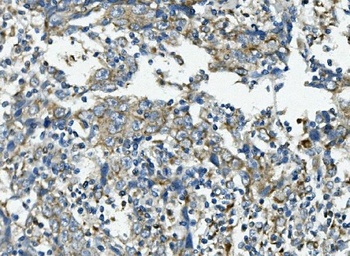 VPS4B/MIG1 Antibody