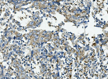 Anti-VPS4B/MIG1 Antibody