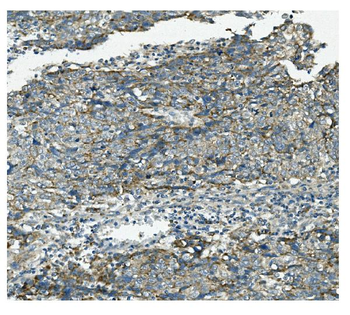 Anti-VPS4B/MIG1 Antibody