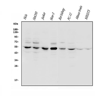 Anti-VPS4B/MIG1 Antibody