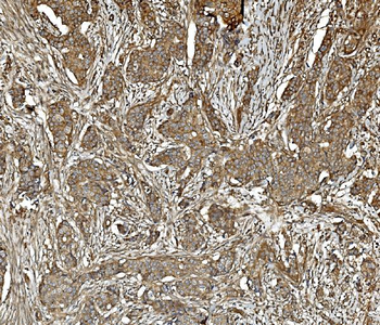 Anti-PP2A-alpha/PPP2CA Antibody (monoclonal, 3B6)