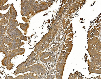 Anti-PP2A-alpha/PPP2CA Antibody (monoclonal, 3B6)