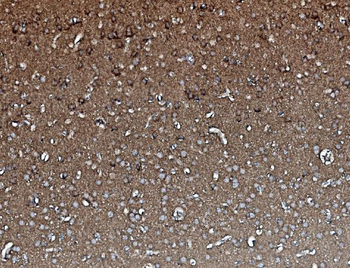 Anti-PP2A-alpha/PPP2CA Antibody (monoclonal, 3B6)