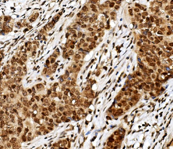 Anti-TIF1 gamma/TRIM33 Antibody (monoclonal, 8I8)