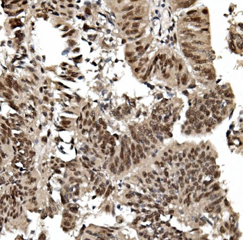 Anti-TIF1 gamma/TRIM33 Antibody (monoclonal, 8I8)