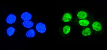 Anti-hnRNP D/AUF1/HNRNPD Antibody (monoclonal, 2B12)