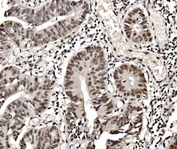 Anti-hnRNP D/AUF1/HNRNPD Antibody (monoclonal, 2B12)