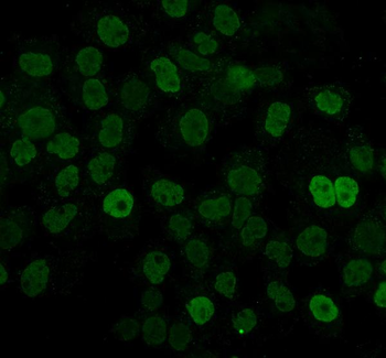 Anti-hnRNP D/AUF1/HNRNPD Antibody (monoclonal, 4F3)