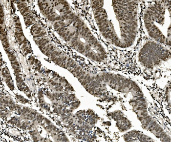 Anti-hnRNP D/AUF1/HNRNPD Antibody (monoclonal, 4F3)