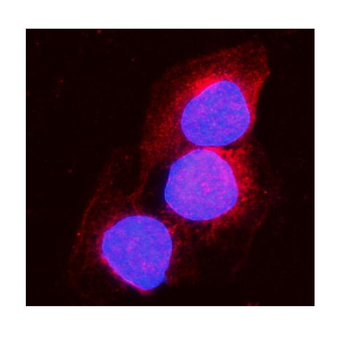 Anti-Aconitase 1/ACO1 Antibody