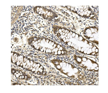 Anti-Aconitase 1/ACO1 Antibody