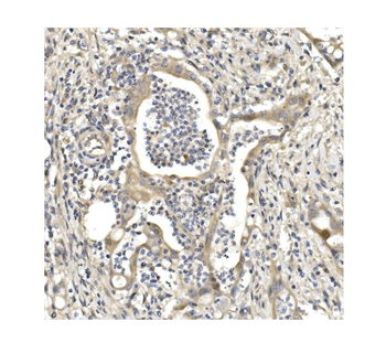 Anti-Aconitase 1/ACO1 Antibody