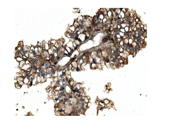 Anti-Aconitase 1/ACO1 Antibody