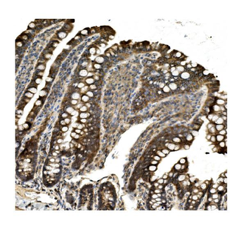 Anti-Aconitase 1/ACO1 Antibody