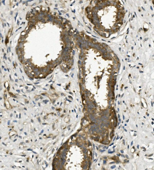 Anti-Arp2/ACTR2 Antibody