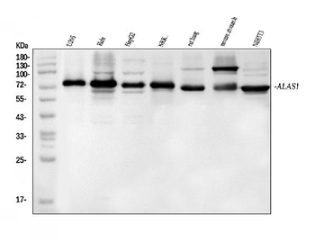 Anti-Alas1 Antibody