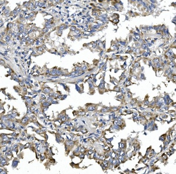 NDP52/CALCOCO2 Antibody