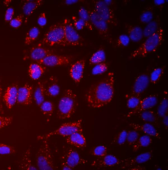 Anti-NDP52/CALCOCO2 Antibody
