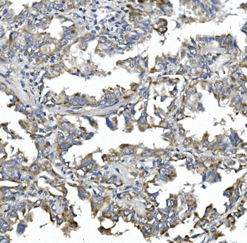 Anti-NDP52/CALCOCO2 Antibody
