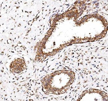 Anti-NDP52/CALCOCO2 Antibody