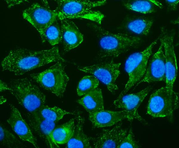 Anti-Caveolin-2/CAV2 Antibody