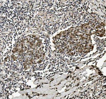 Anti-HP1 alpha/CBX5 Antibody