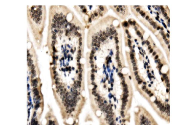 Anti-HP1 alpha/CBX5 Antibody