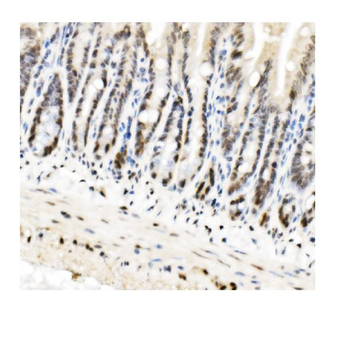 Anti-HP1 alpha/CBX5 Antibody